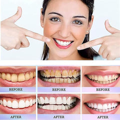 Oralhoe Nicotinamide Dazzle White Toothpaste 100g UAE | Whitening Toothpaste for Fresh Breath