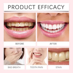 Oralhoe Nicotinamide Dazzle White Toothpaste 100g UAE | Whitening Toothpaste for Fresh Breath