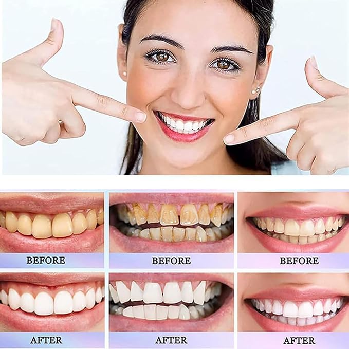 Oralhoe Nicotinamide Dazzle White Toothpaste 100g UAE | Whitening Toothpaste for Fresh Breath